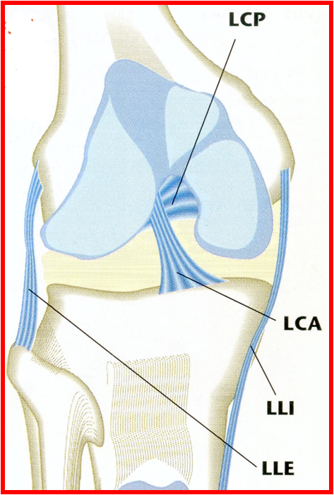 Ligamentoplastie